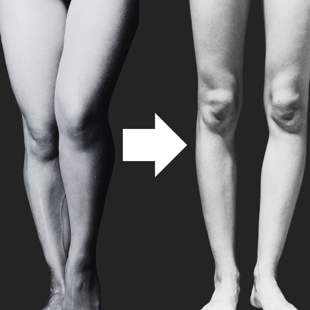 足痩せダイエットした女性のbefore-after
